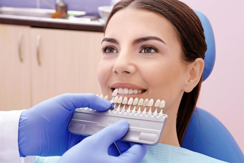Modern Dental Veneers: New Trends and Technologies in 2026